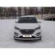 Защита передняя для Hyundai Tucson 2015- (ОВАЛ) D 75х42